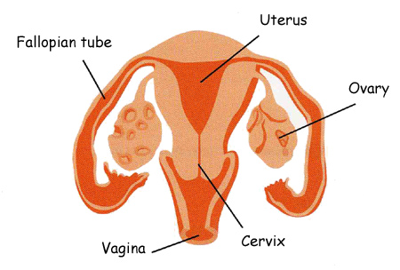 A picture of the female reproductive system, with indicators to the Vagina, Cervix, Ovaries, Uterus, and Fallopian tube